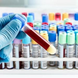Researching the Link Between Blood Type and COVID-19 Risk
